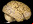 Cerebro vivo construido con células de cáncer Cerebro vivo construido con células de cáncer